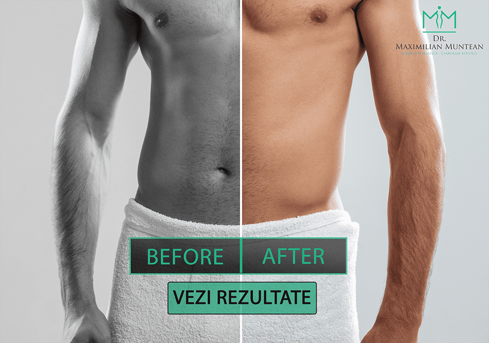 Chirurgia zonei genitale masculine - Clinica Zetta
